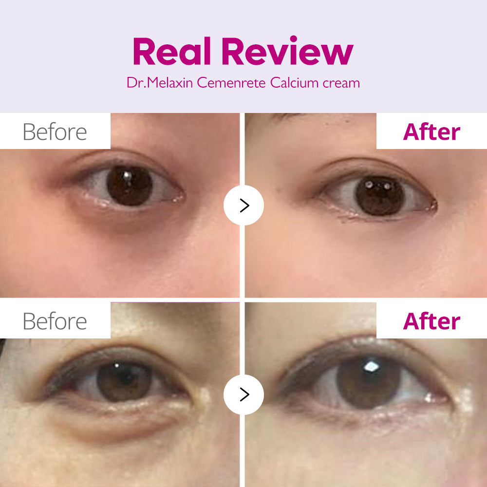 Calcium Intense Cream