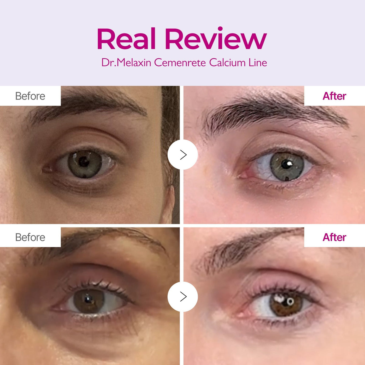 Calcium Intense Ampoule Plus