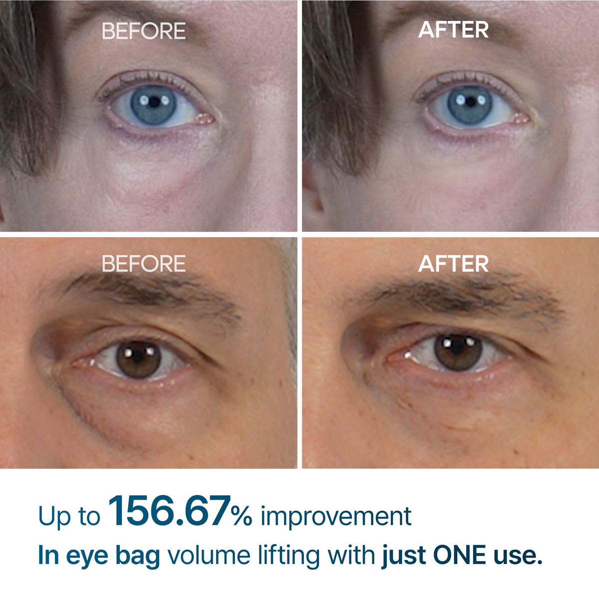 [Day&Night Care] Eyebag Lifting Duo