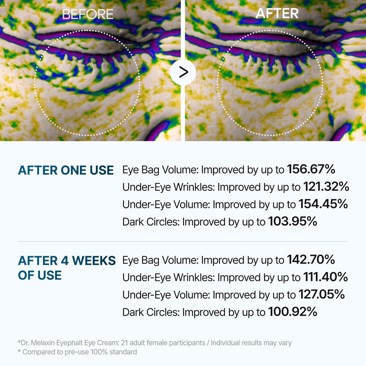 Eyephalt Day & Night Firming Routine Set