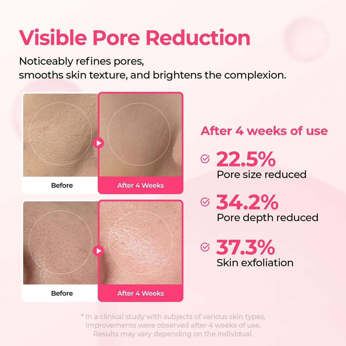 EDITOR'S PICK | 7-Step Korean Glass Skin Routine Set