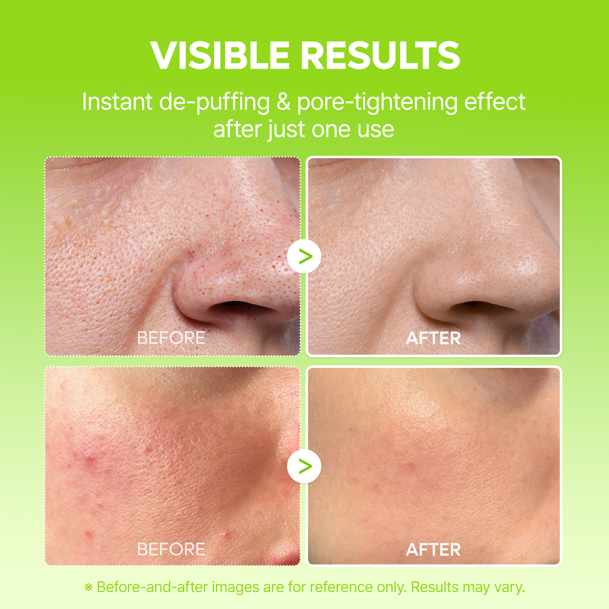 CACTOX V-Lifting Mewing Band 4EA