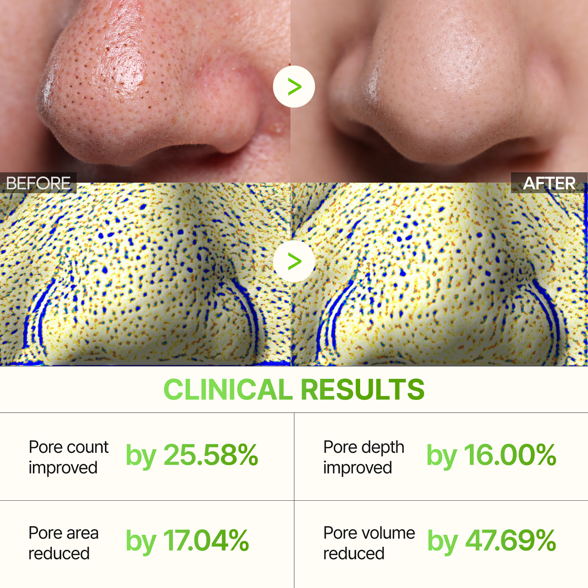[CLEARANCE SALE] CACTOX 3-Step Nose Mask Pack