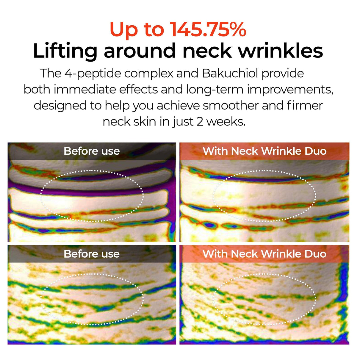 Neck Firming 3-Step Routine Set