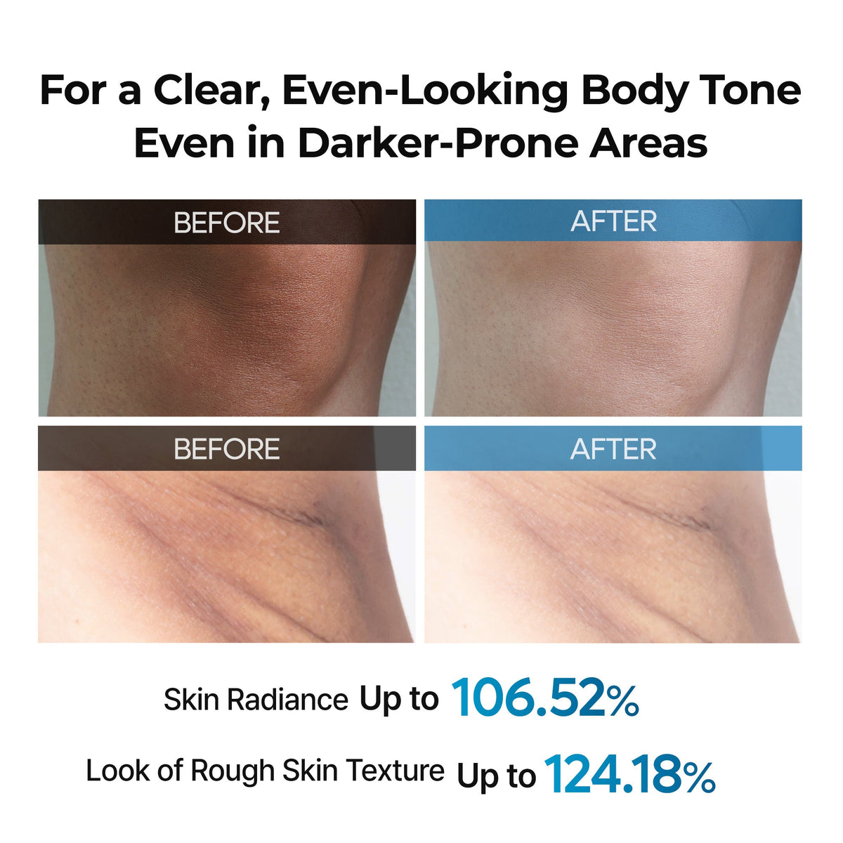 BESTSELLER | Peel Shot Exfoliating TX Spray